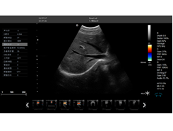 b超仪器监测图像
