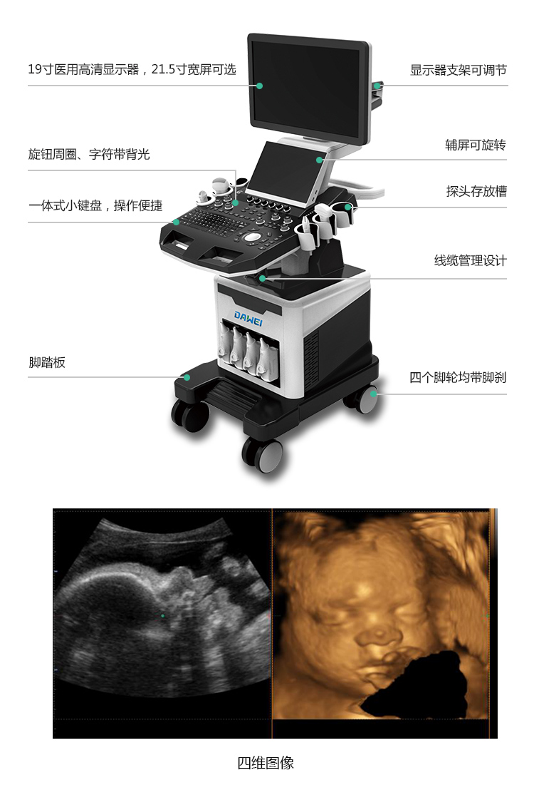 高端四维彩超成像
