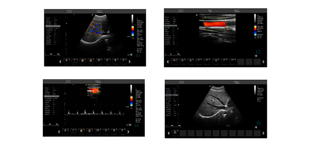 彩超机临床图