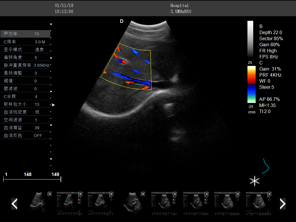 B超临床图