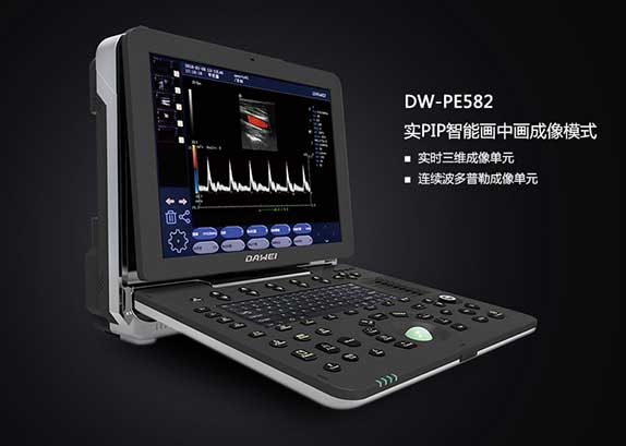 大为彩超机DW-PE582