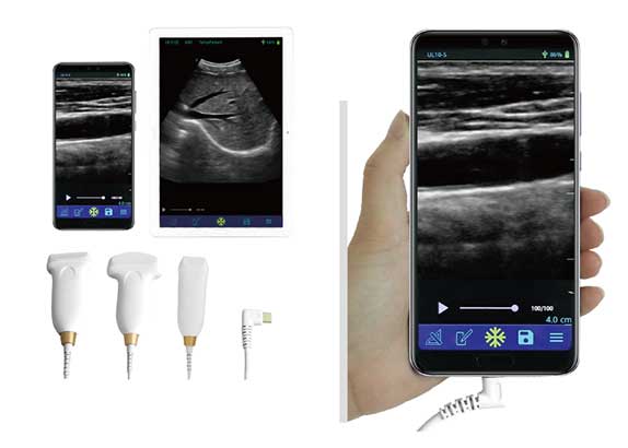便携式B超机：功能优化、一机多能成主流