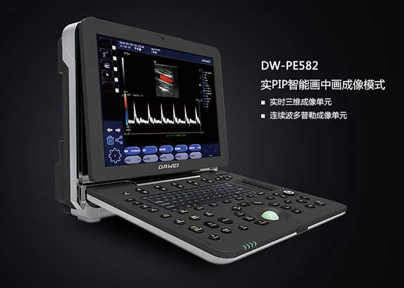 便携式超声诊断仪DW-PE582
