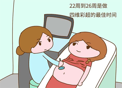 四维彩超检查优势及彩超检查时间