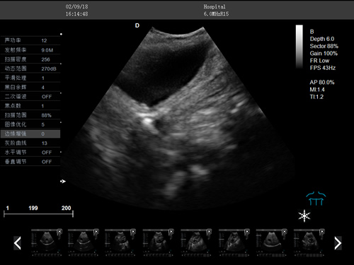 兽用彩超机检测图