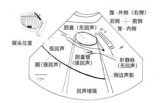 犬肝脏的声像图